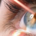 What are the Disadvantages of Laser Eye Surgery?