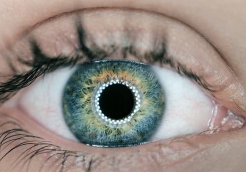 Does Laser Eye Surgery Weaken the Eye?