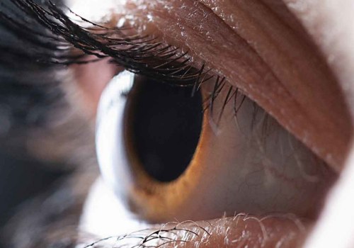 Is LASIK Worth It Financially? The Benefits and Risks of the Procedure