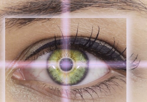 Can You Have Multiple LASIK Procedures? Everything You Need to Know