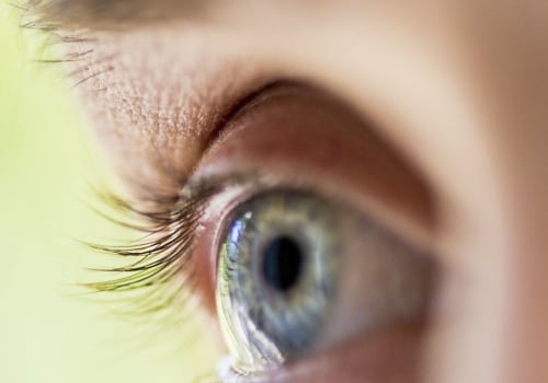 When is it Too Late for LASIK Surgery?