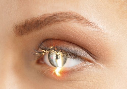 Will Laser Eye Surgery Last a Lifetime?