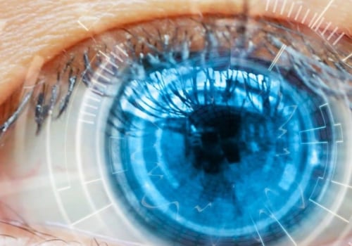 Does Laser Eye Surgery Last Forever?