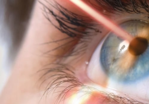 Unlock the Benefits of Laser Eye Surgery: A Comprehensive Guide