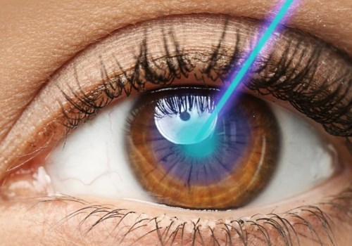 Does Laser Eye Surgery Permanently Fix Eyesight?